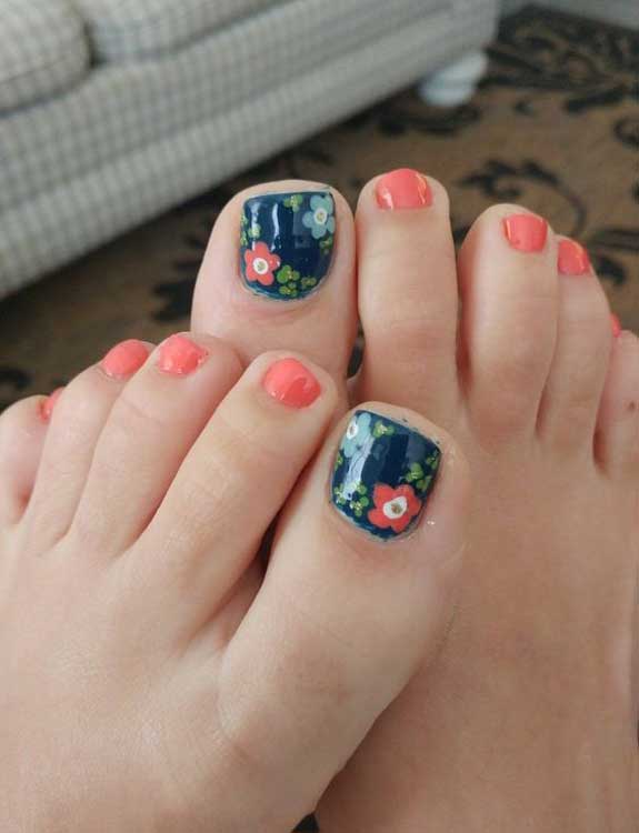 Toe Nails With Fantastic Pedicure Ideas