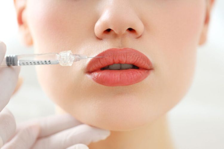 Are Dermal and Lip Fillers Safe?-Dermal Lip Fillers