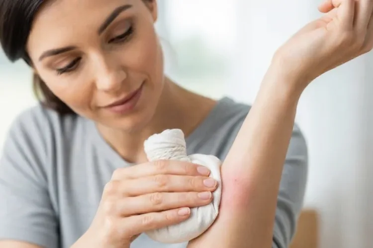 A woman gently applying a cool compress wrapped in soft cloth to inflamed skin, calm expression.